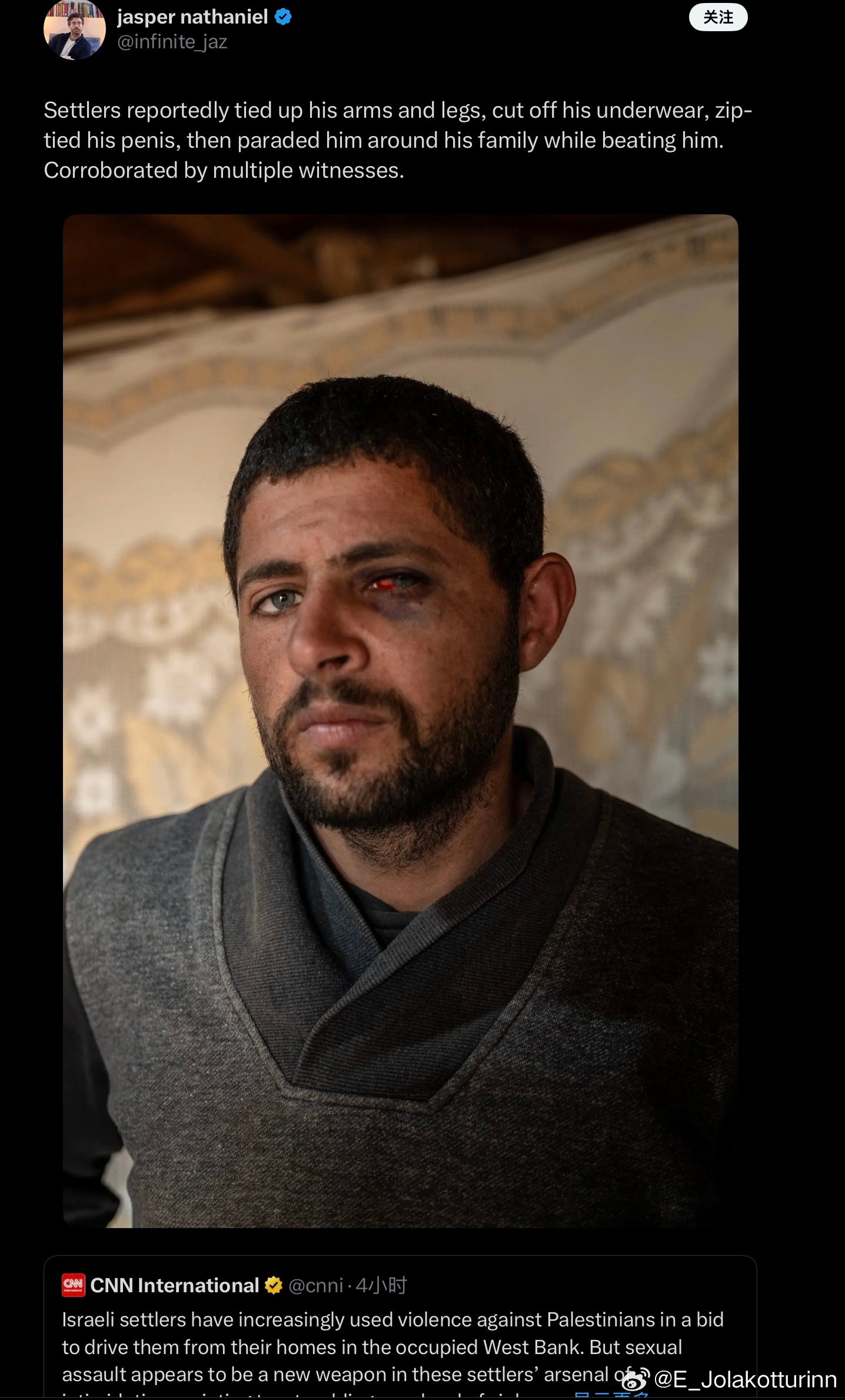 当CNN都忍不住站出来揭露以色列定居者对巴勒斯坦人的性暴力罪行时，可想而知真实情