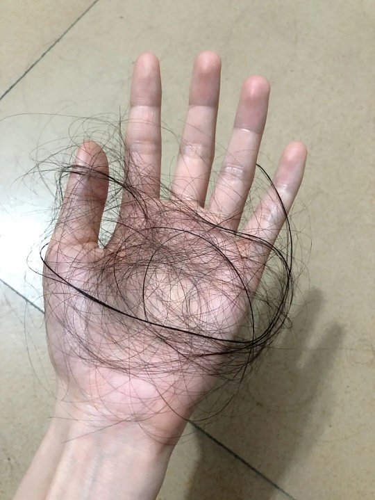 女子收集掉落头发给妈妈钩假发细碎的发丝，积攒起来就变成了最温情的礼物。平日里不经