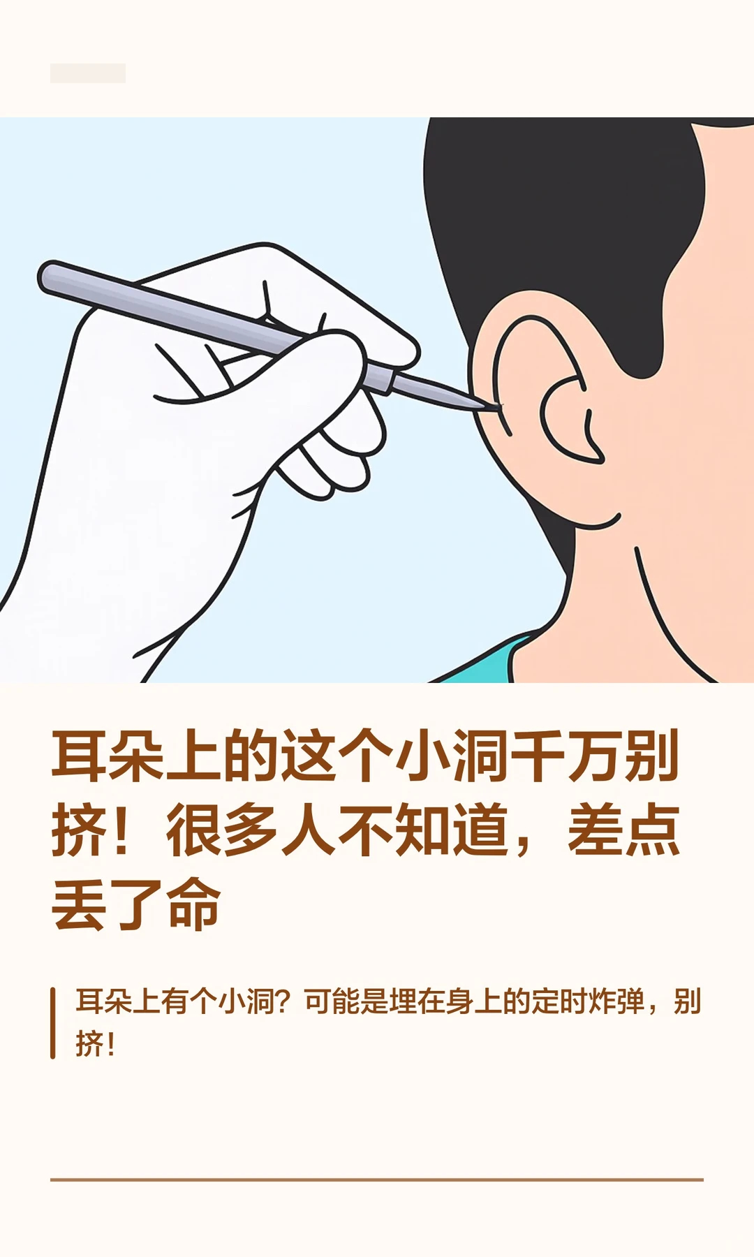 耳朵上这个小洞千万别挤你仔细观察过自己的耳朵吗？有些人耳廓上方、靠近脸颊的位置，