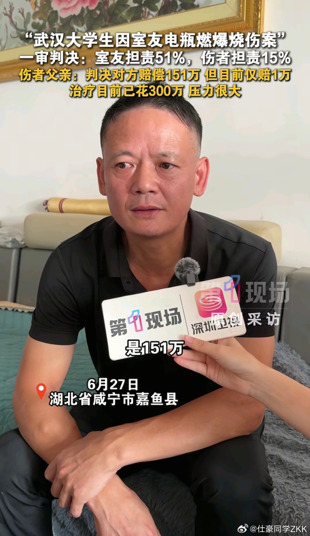 被电瓶烧伤大学生判赔151万仅获1万  室友担责51%，伤者担责15%。 法院判
