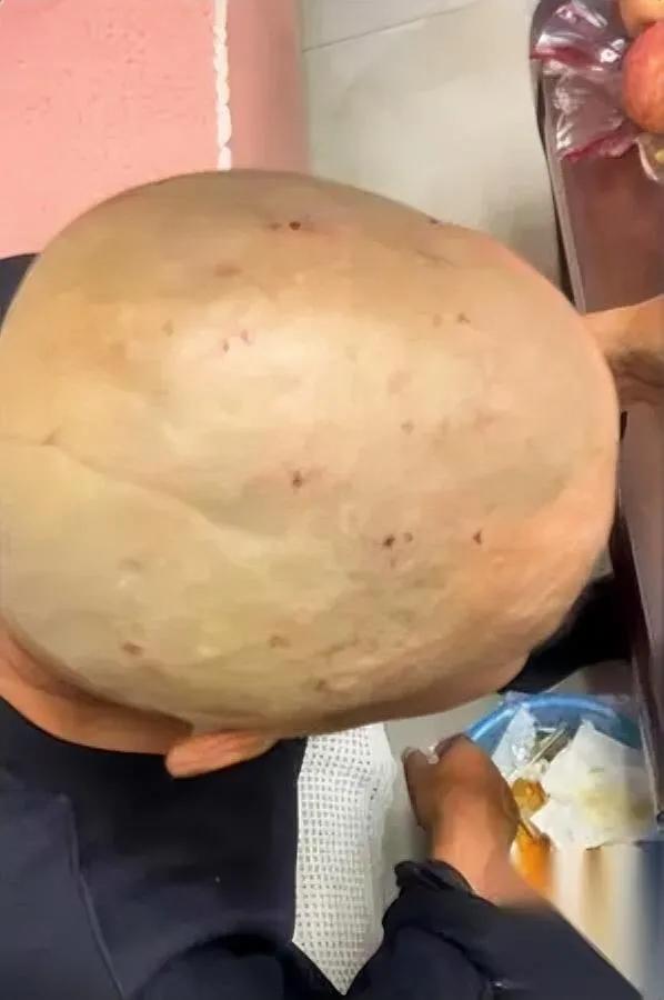 大爷花10元剃头竟满头伤

女儿怒了想讨说法

但大爷一句话让全网沉默…

周末