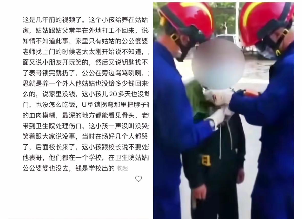男孩遭表哥U型锁
囚禁二十多天整出重伤，
最新消息说
姑姑家咬死是小孩闹着玩儿。