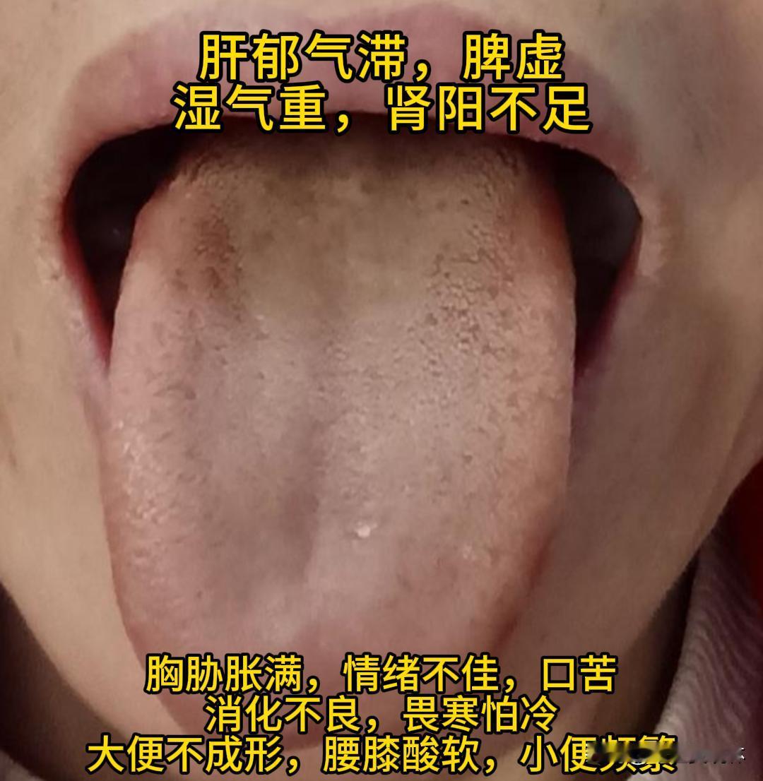 公益舌诊！ 抽空帮大家看舌象！

把你的舌象发过来，一起看看你的健康状况！

1