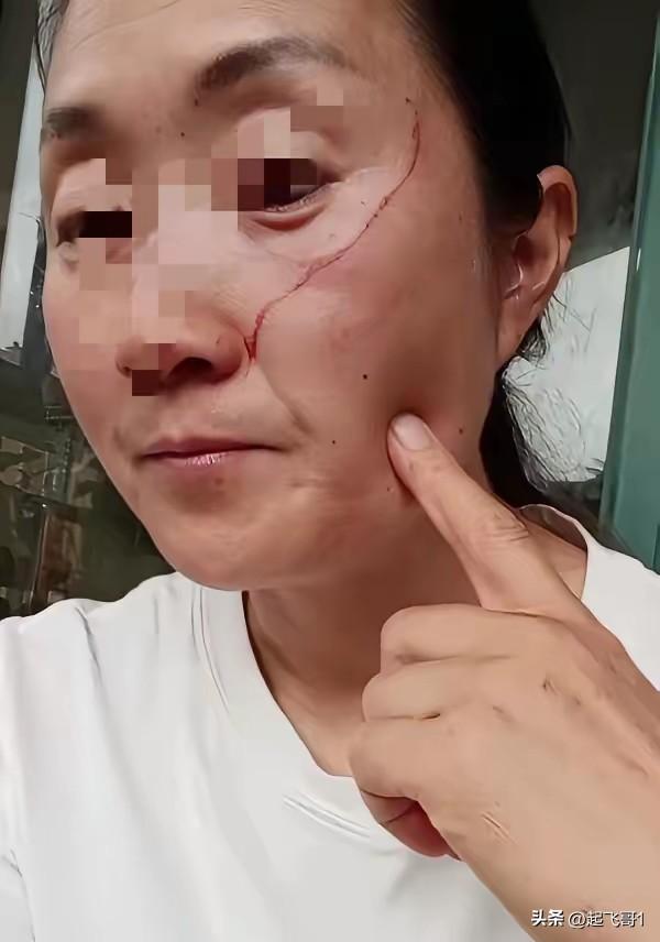 一位妈妈在网上哭诉说，自己的脸让女儿给挠花了。
女儿高考结束了，一天中午她做完饭