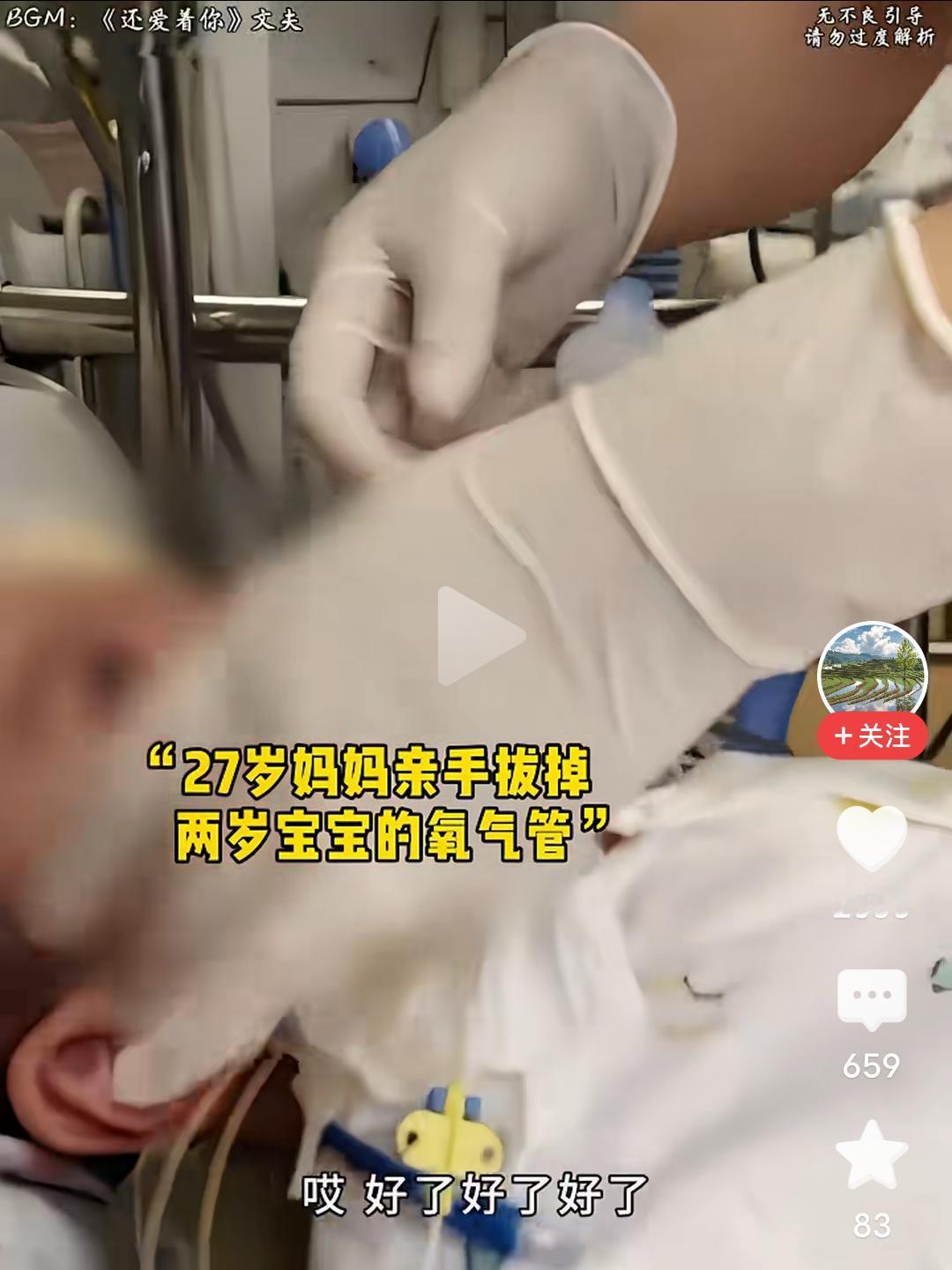 泪崩了！忍不住的流泪，忍不住的泪流满面！
       27岁的妈妈亲手拔掉了两