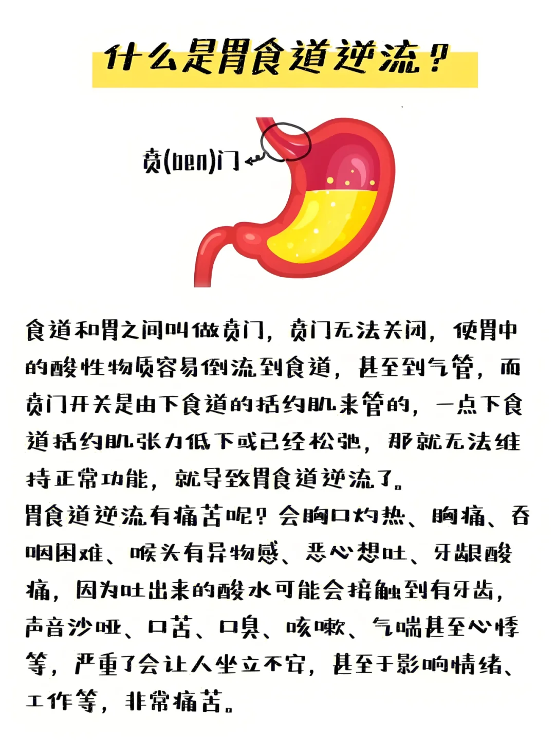 什么是胃食道逆流？