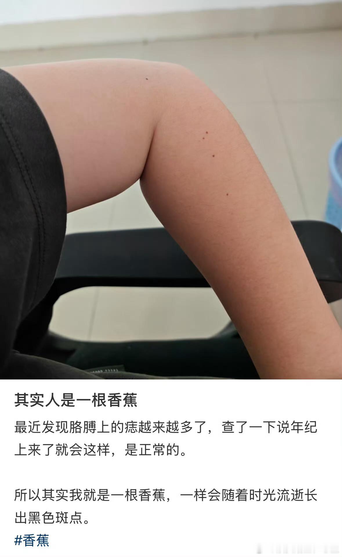 其实人是一根香蕉香蕉长点点后味道越来越香甜，人长了斑点后只会越来越有老人味