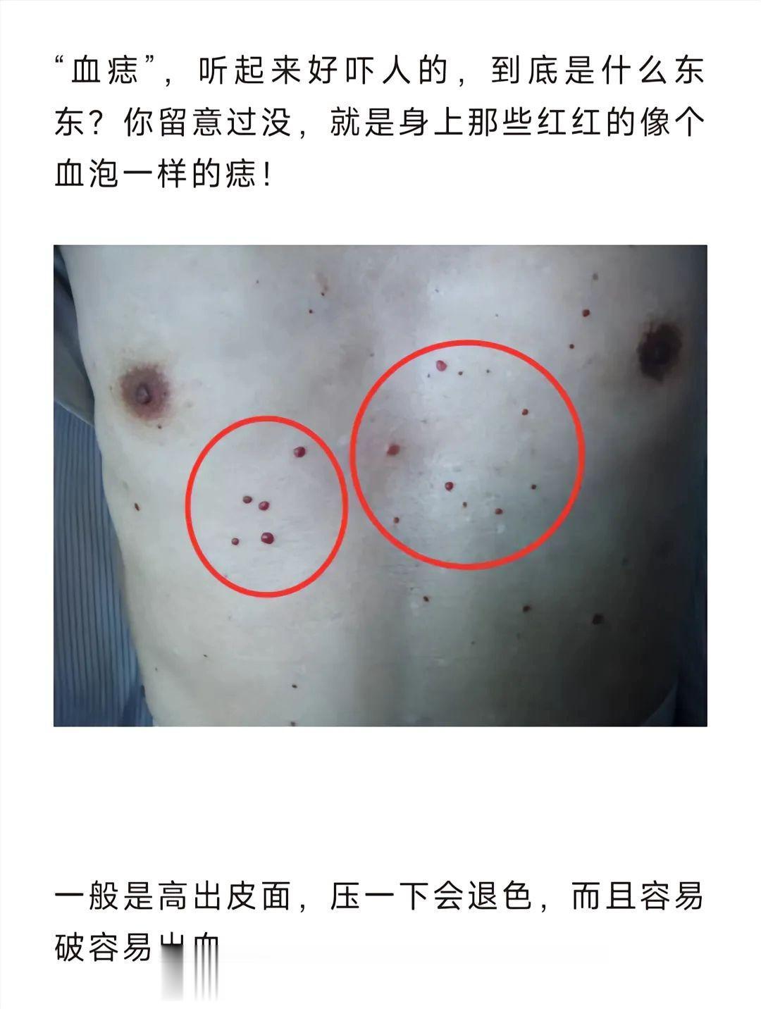 你身上是不是也有这个