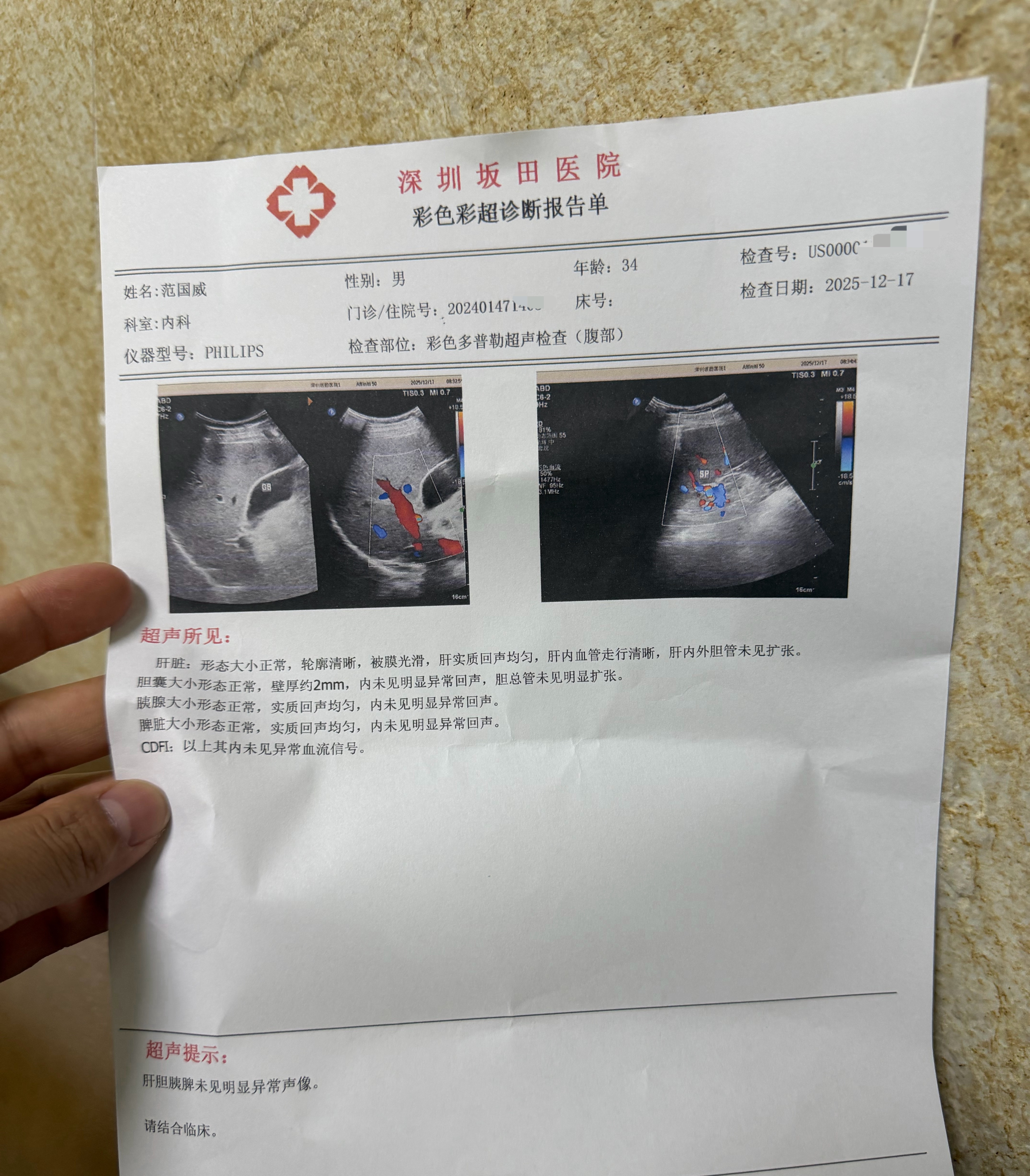 手机AI可以看医院检查单吗，或者有没有行医的粉丝，半年前检查有脂肪肝，帮我看下有