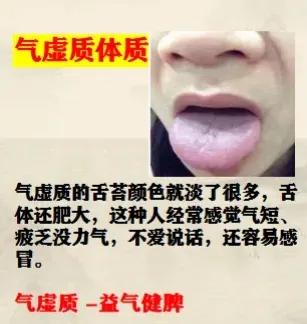 想知道自己的体质类型吗？今天就来聊聊九种体质及其相应表现，快来看看你是哪一种吧！