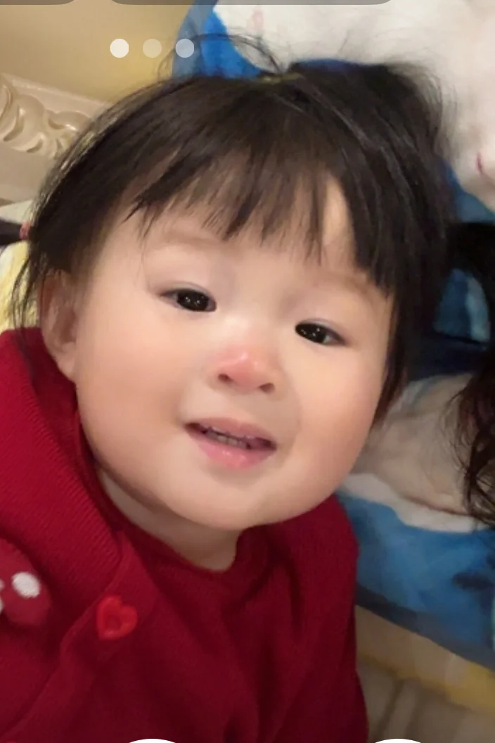 被蚊子咬肿鼻子的小丑炸