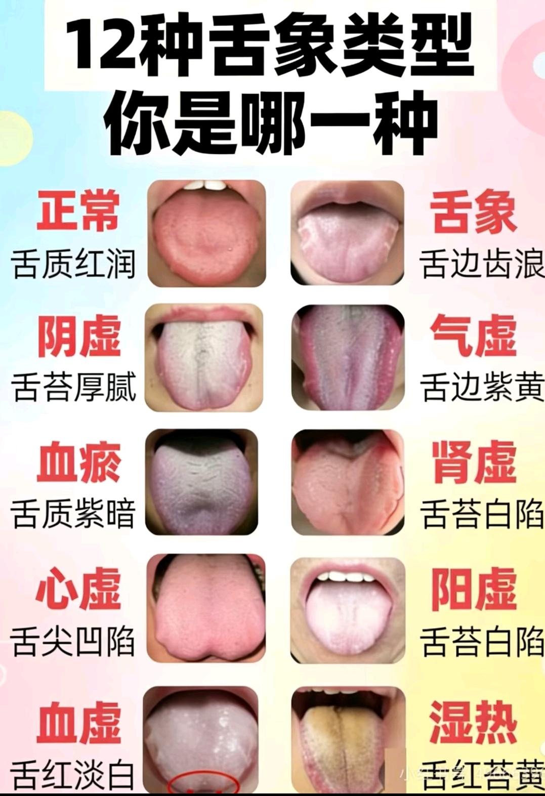 健康科普 中医养生 实用冷知识 每天跟我涨知识 中医文化