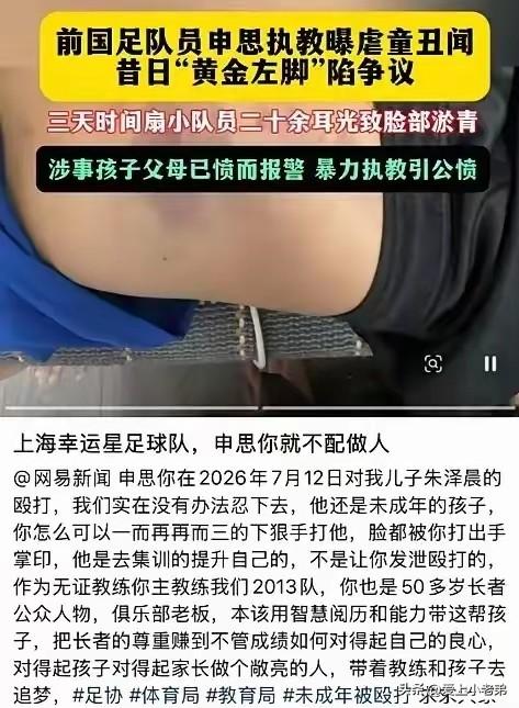 申思有错，那么孩子家长呢？别忘了，当初可是双向奔赴
申思掌掴小球员一事引发轩然大