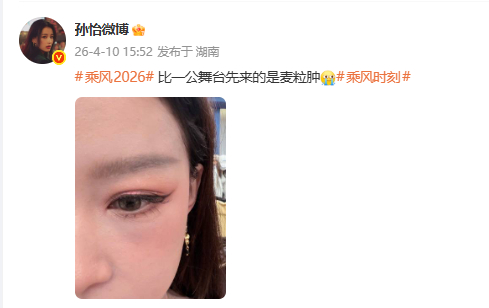 孙怡麦粒肿孙怡长麦粒肿了 ：比一公舞台先来的是麦粒肿