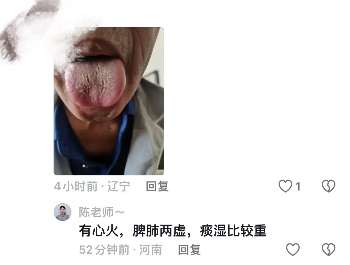 涨知识  1.肝郁，脾肾阳虚，痰湿重 2.脾胃虚弱，寒湿重 3.脾虚有...