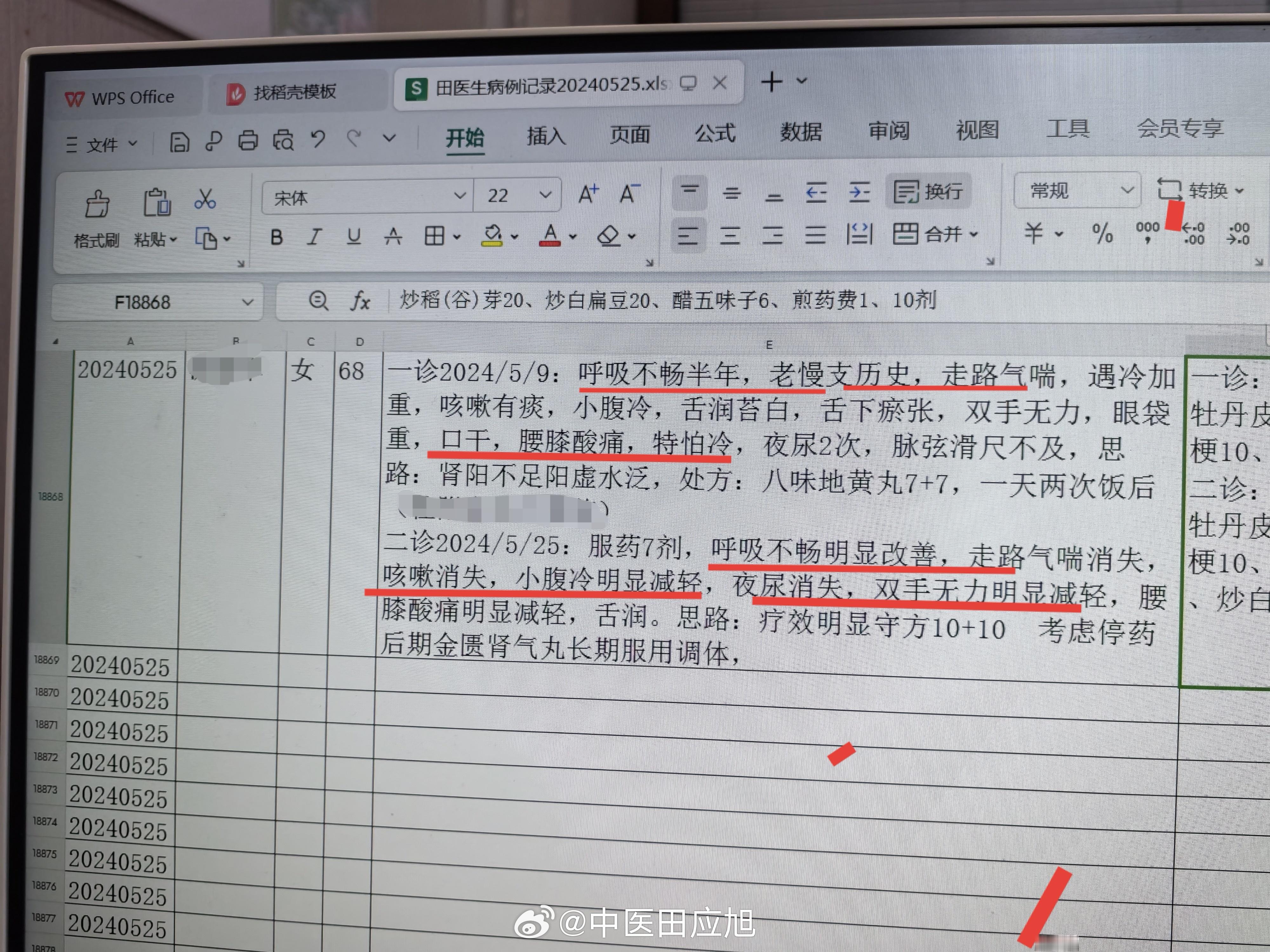 #中医#  68岁阿姨，呼吸不畅半年，走路气喘，腰膝酸软小腹冷，怕冷夜尿，双手无