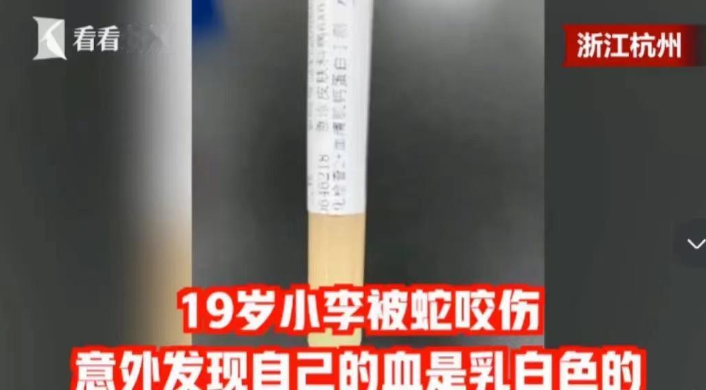 2020年，杭州19岁男子被蛇咬伤，竟发现自己的血是白色？网友：蛇救了你！

当