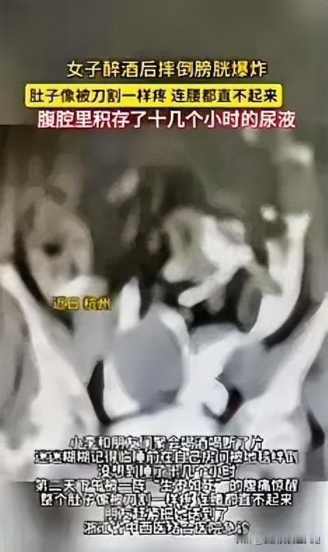 活人能让尿憋死？”杭州，一位女子和朋友参加聚会，期间女子也是放开了喝酒，谁知道喝
