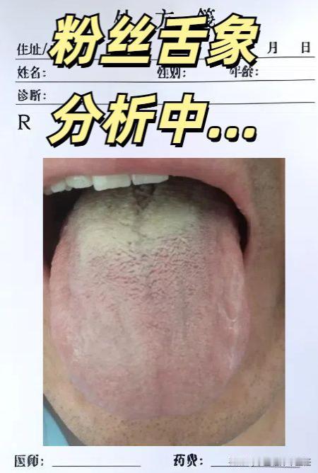 又碰到这种舌象了，我再说最后一次：补肾之前记得健脾！

患者主要问题：欲望低下，