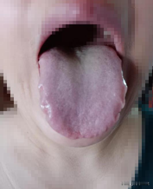 姑娘，舌头都这么紫了，真的不知道自己有血瘀吗？平常肚子痛的厉害，别只说自己就是脾