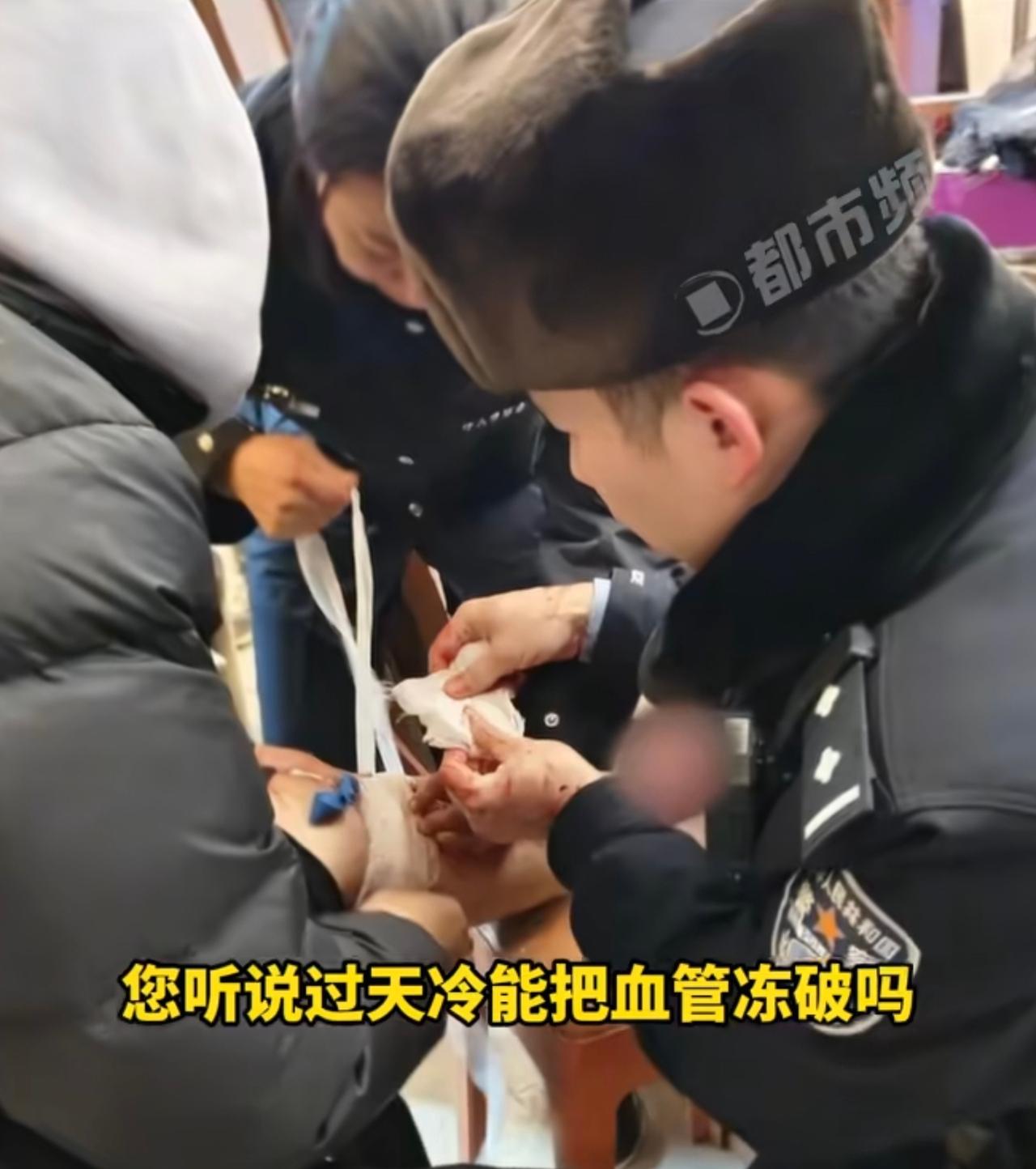 在东北竟然冻的血管爆裂，可能东北人都不知道还有这样的事情。

也许从小父母就告诉