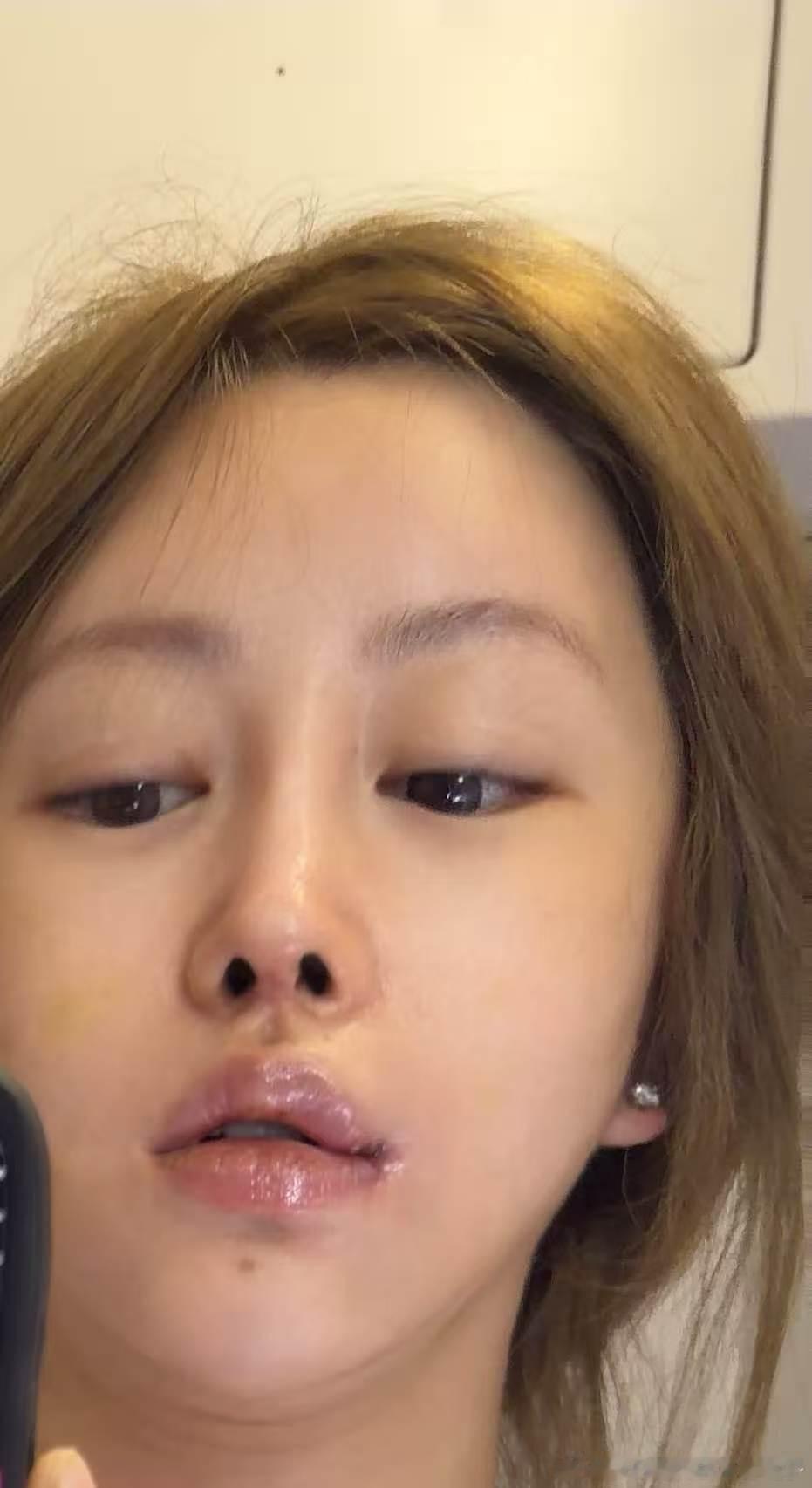 我这双下巴受不了了 好想做颈阔肌啊 