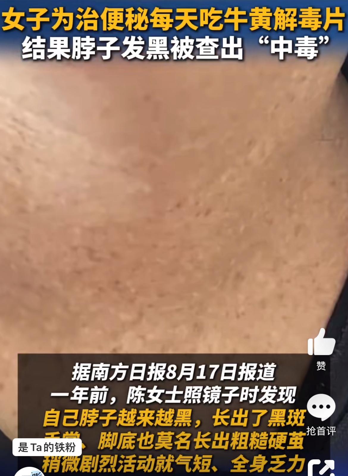女子为治疗多年老便秘猛吃牛黄解毒片，结果重金属中毒。很多女人都有便秘，在中医看来