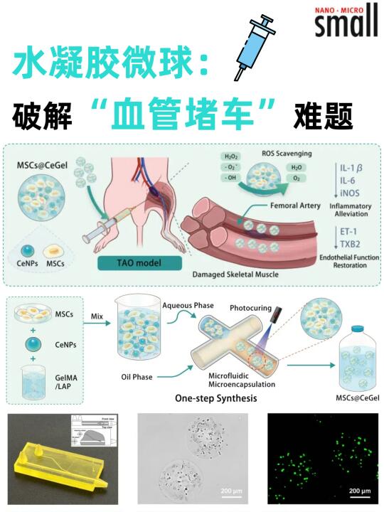 水凝胶微球，破解“血管堵车”难题