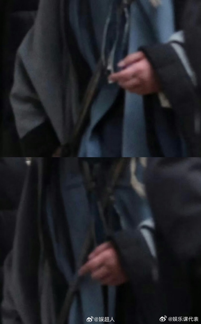 杨洋的手还肿着 注意休息啊！ 