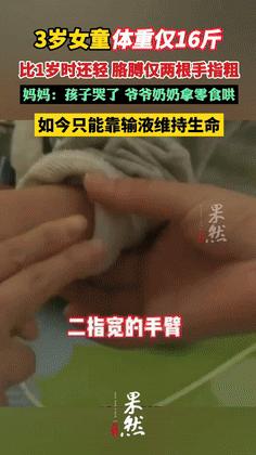 “这样的人不配当奶奶！”河南，3岁女孩体重仅16斤，胳膊只有“两指粗”！不料，医