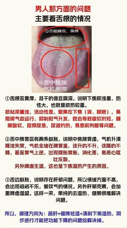 舌象分析