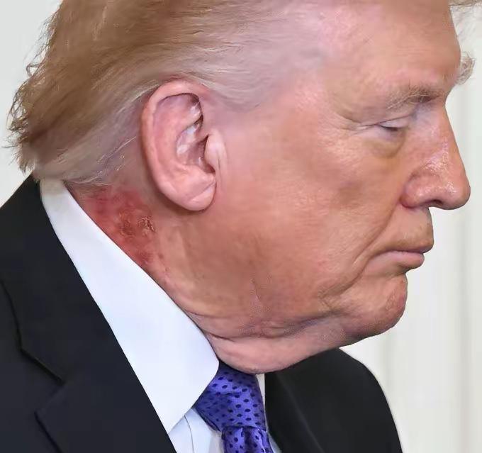 美媒再度炒作：特朗普身患重病

美媒又开始拿特朗普的身体说事，翻来覆去就那点事，