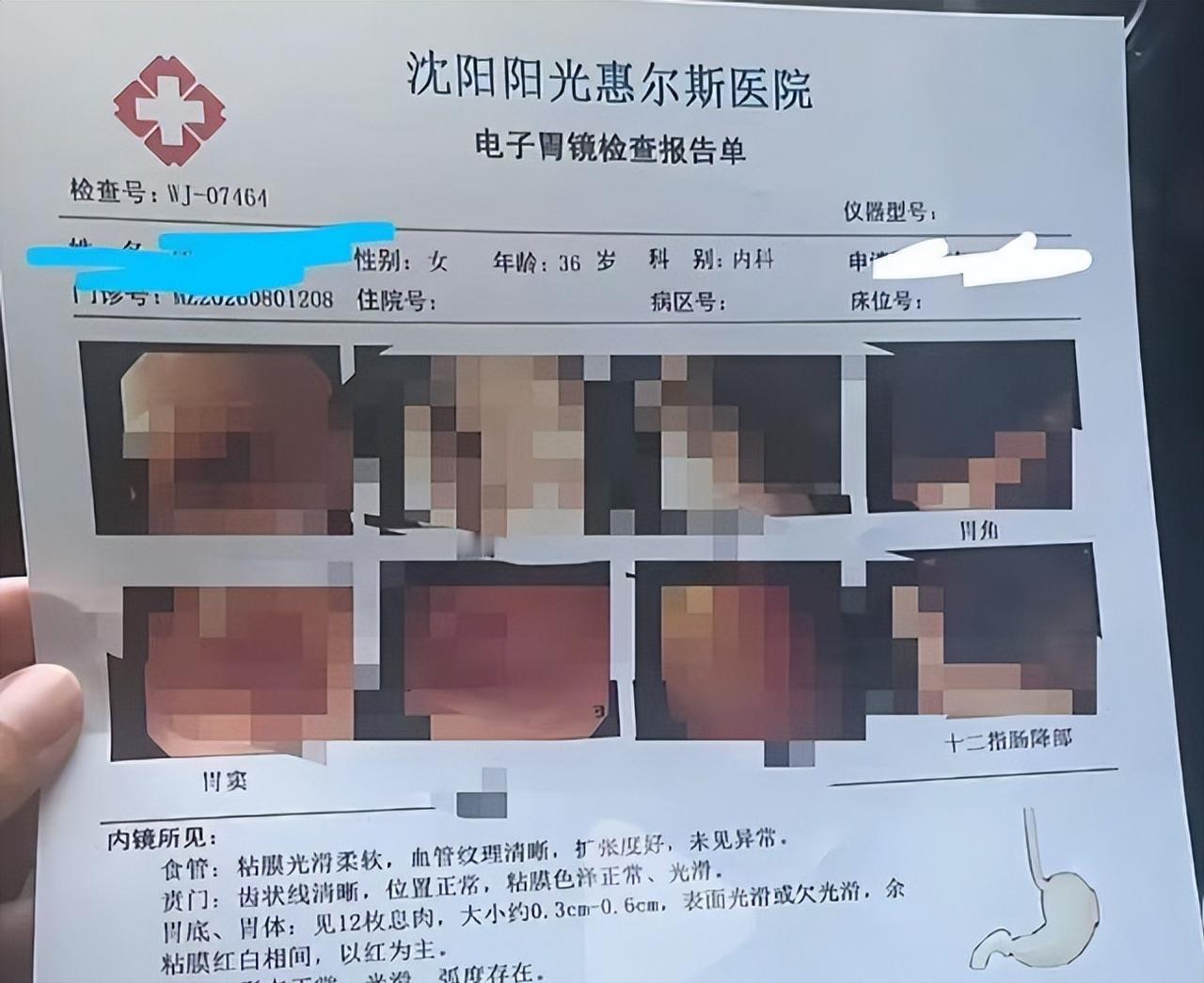 简直离谱到家了！辽宁沈阳，徐女士陪老公参加单位体检，自己顺手也查了胃肠镜。

麻