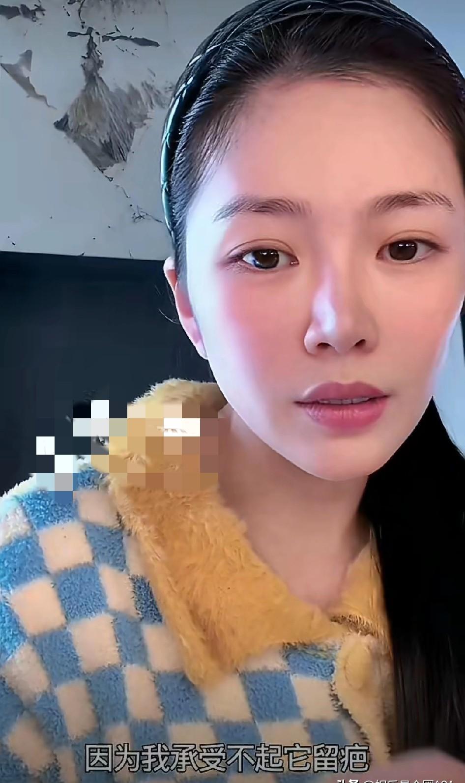 杜淳妻子直播回应整容质疑，一句话让全网沉默了！
“我是疤痕体质，脸上动刀等于自毁