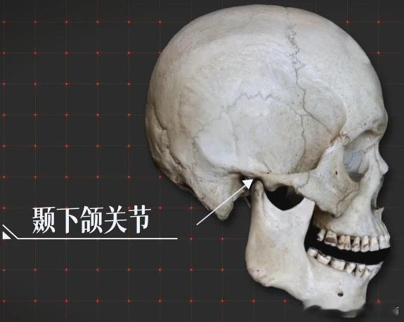 颞下颌关节紊乱 有没有整牙正畸之后，出现张嘴弹响、张不开嘴、脸歪的朋友？颞下颌关