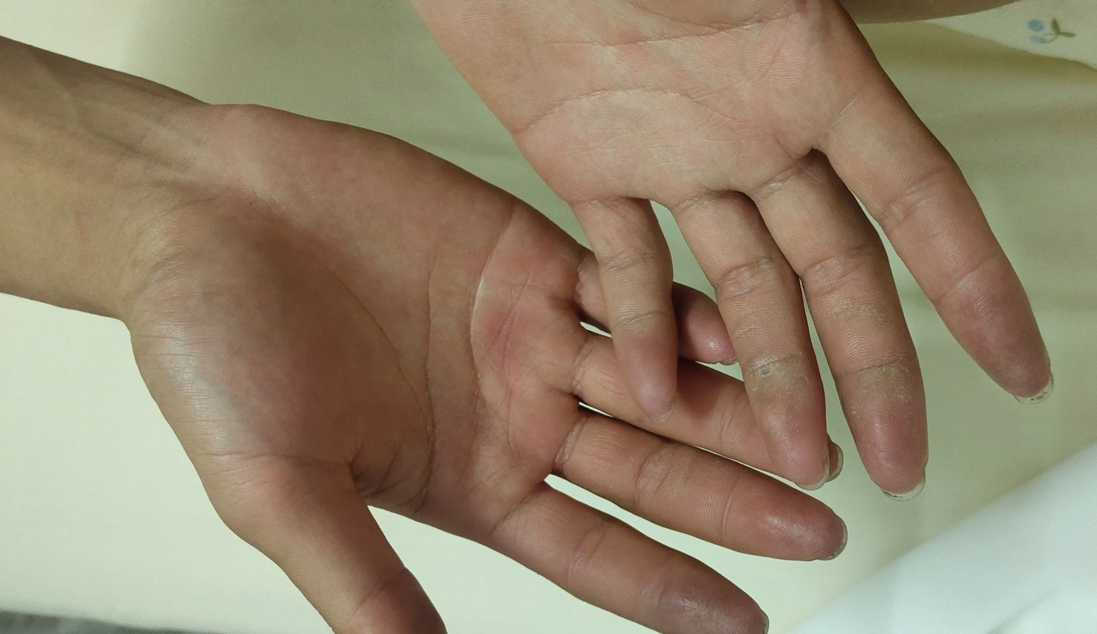 爱的最高境界是心疼 怎么不心疼呢 他也才二十来岁意气风发的年纪却双手双...