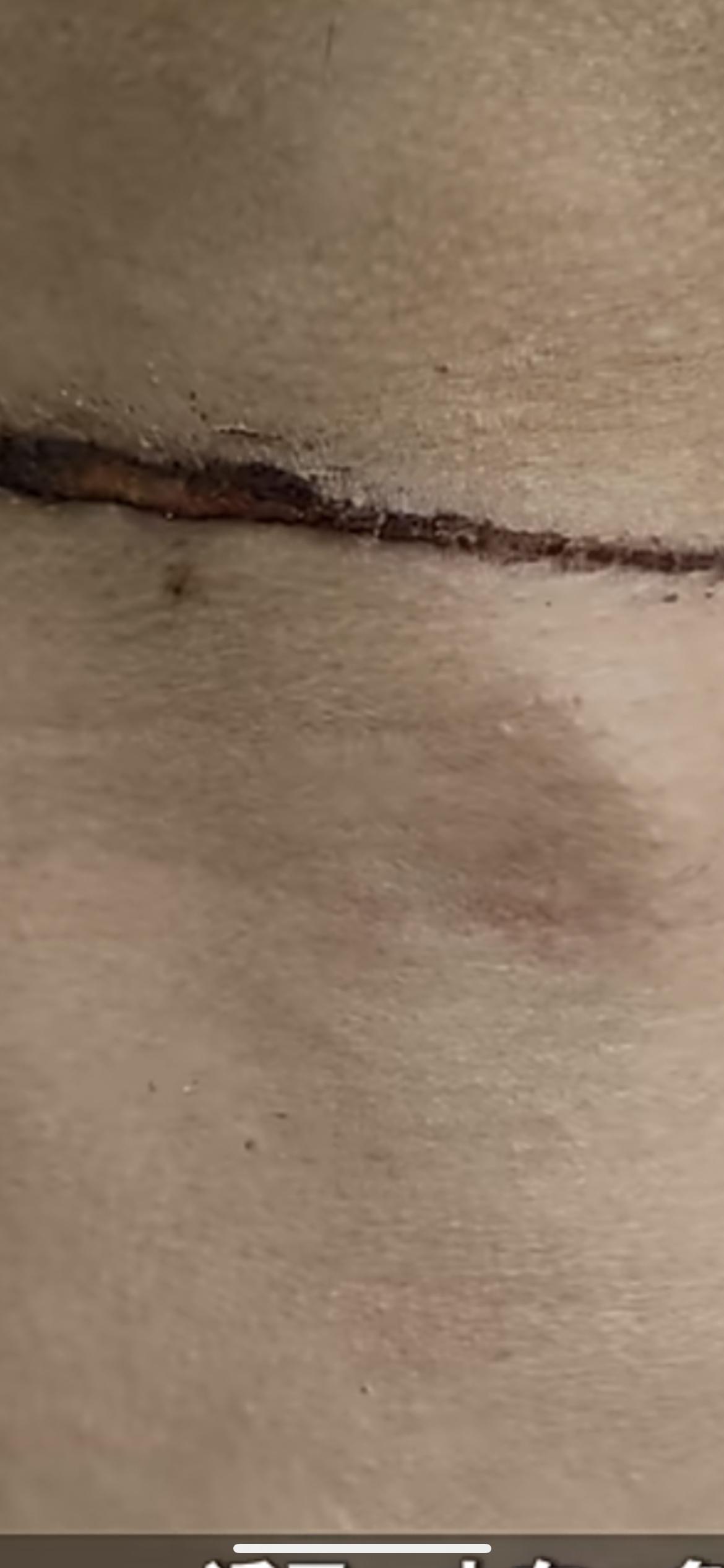 近日，山东一名男子在夜间骑电动自行车途经所住小区广场时，遭一条私自拴设的晾衣绳“