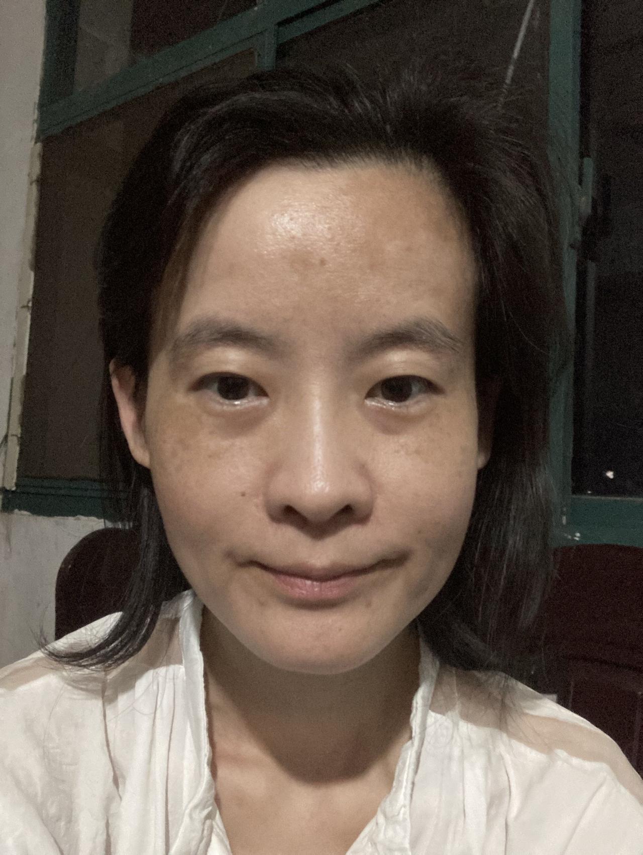 满脸疲惫，怎么能不疲惫呢？

心跳快，肺不好，支括，胃疼，眼睛疼，肾尿蛋白，肠道