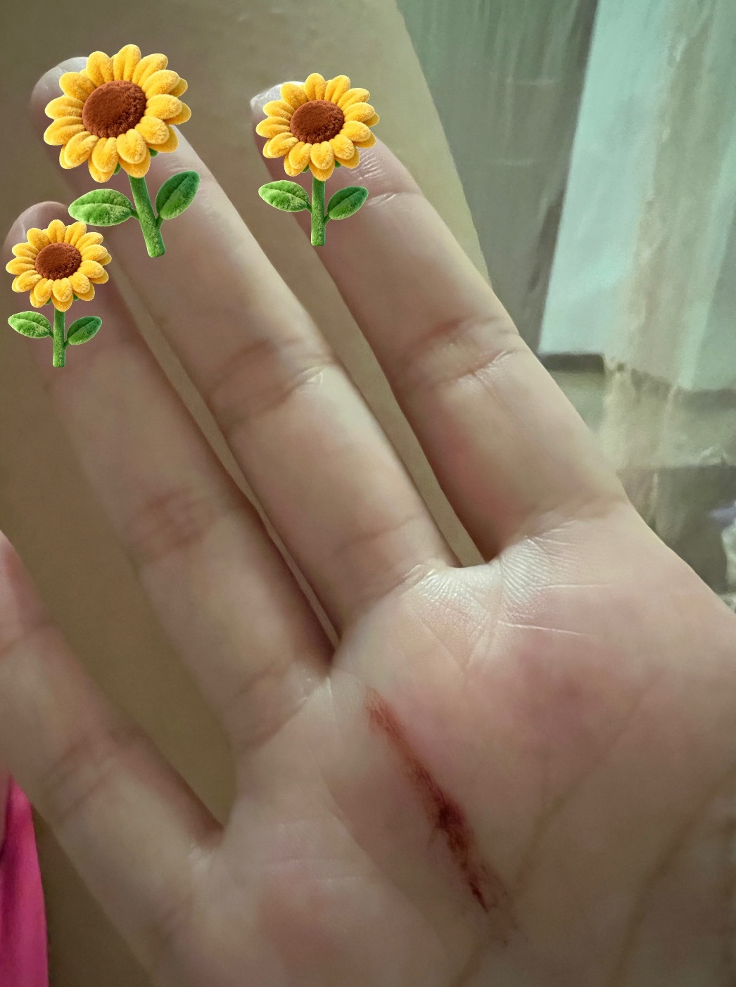 老二终于回来了，睡前必须好好检查一下蚊子，结果抓到了三只、有一只应该是刚吃饱的！