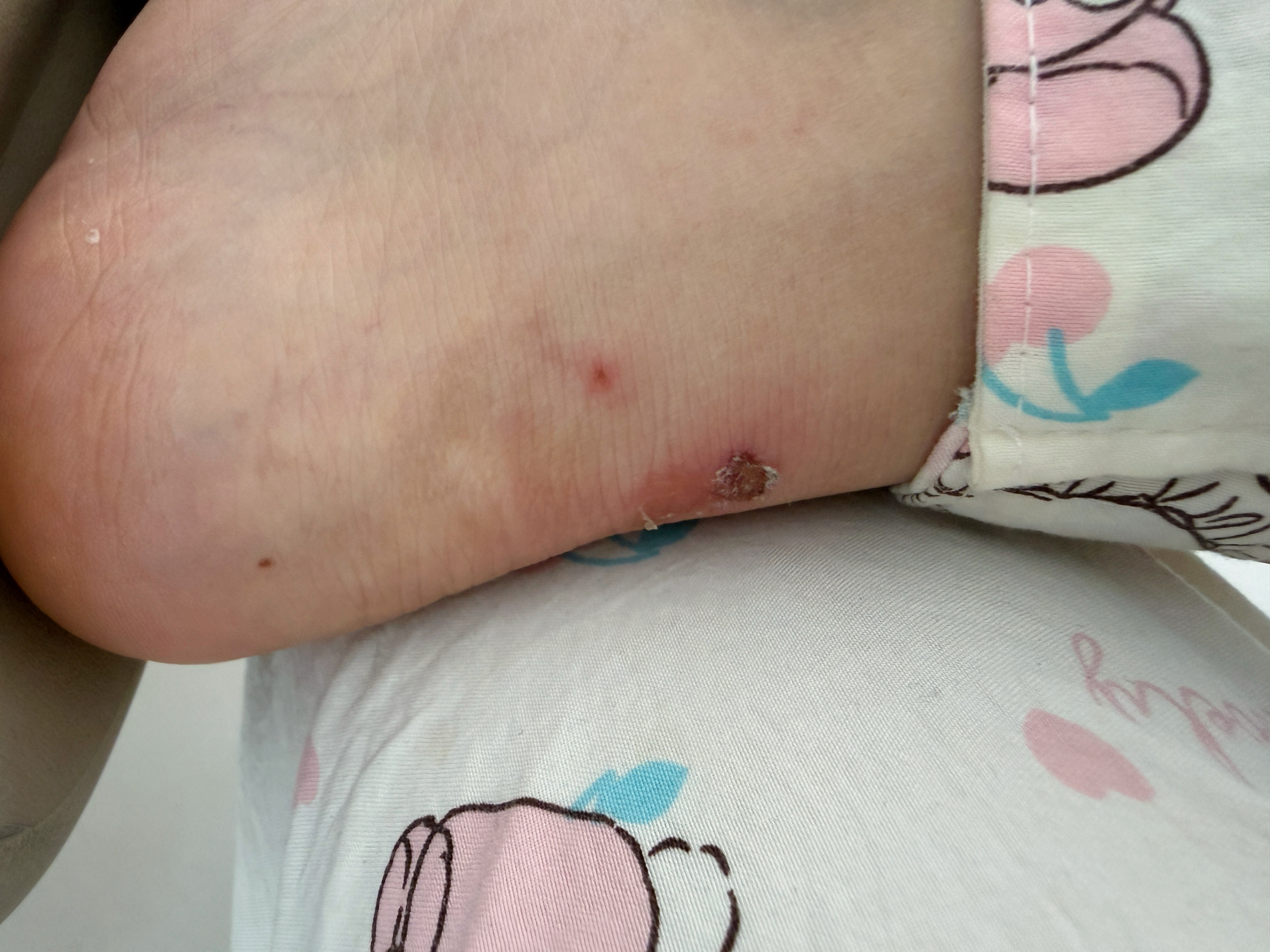 这双脚过不了好日子。一穿贵的鞋子，它就这幅德行。