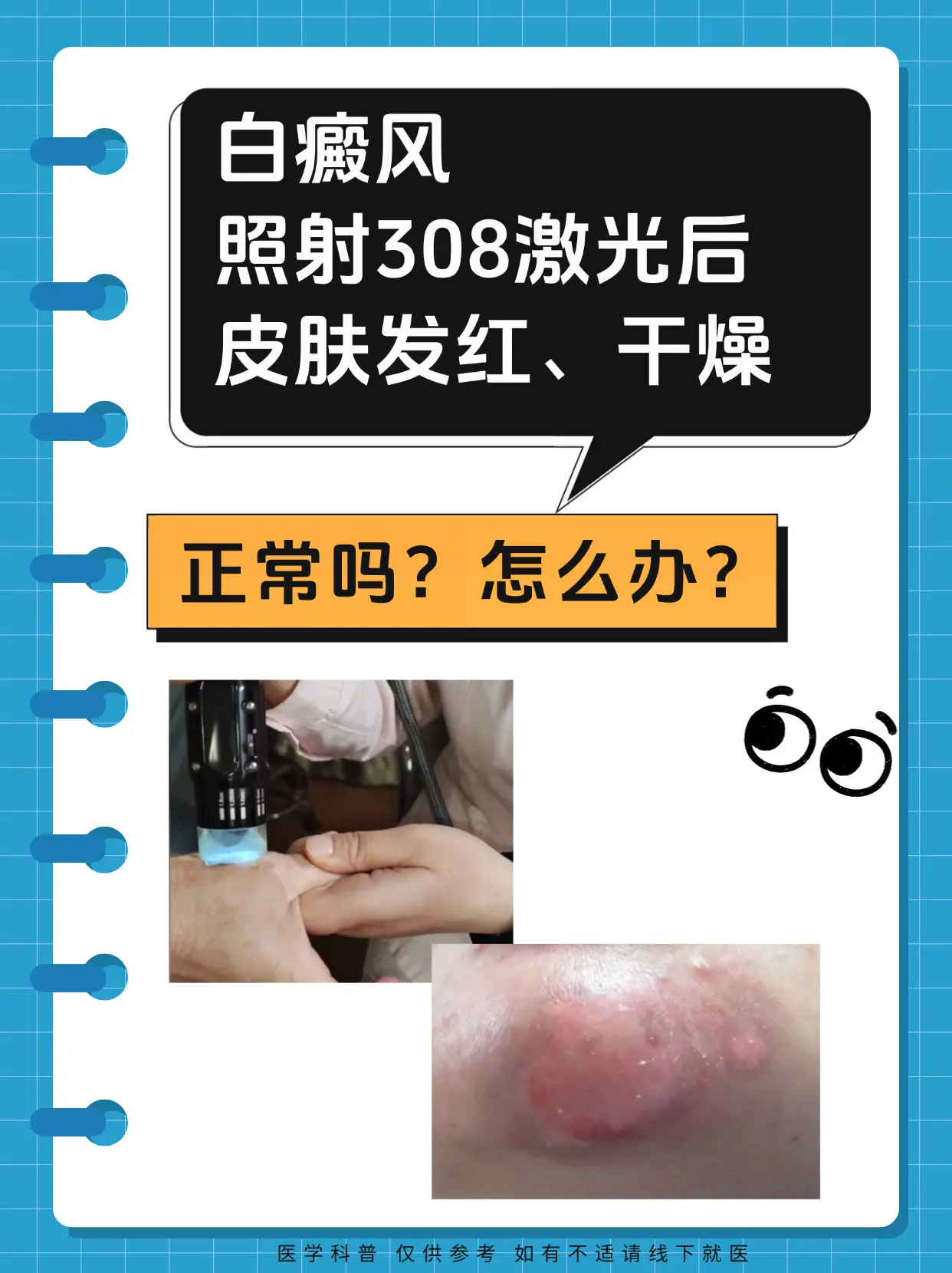 医学科普 白癜风 白癜风科普 抖出健康知识宝藏  医疗健康创作训练营