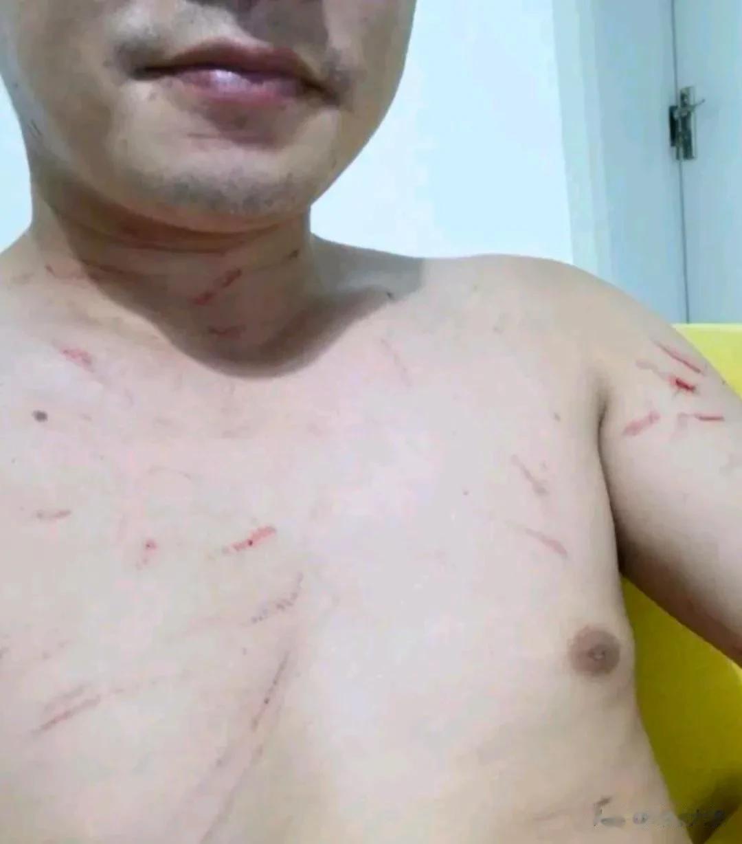 “老婆在老公的身上挖呀挖呀挖，挖长长的伤口结大大的疤[尬笑]”有网友建议男主角：