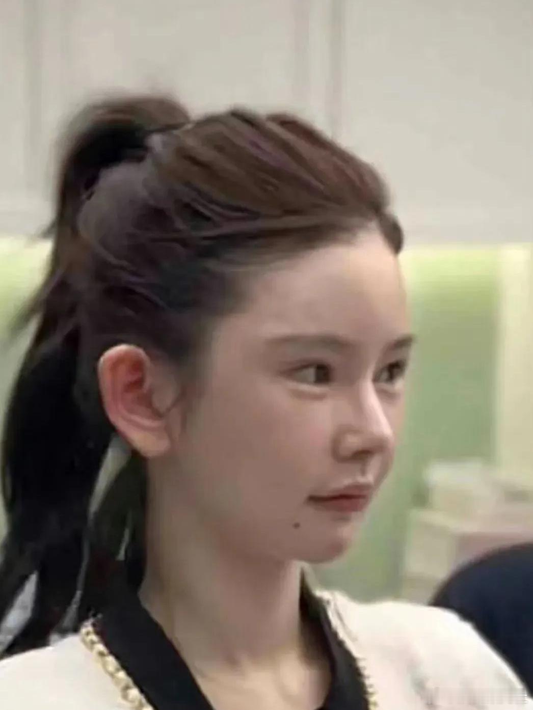 去年还是整容模版，今年就变样了 ​​​