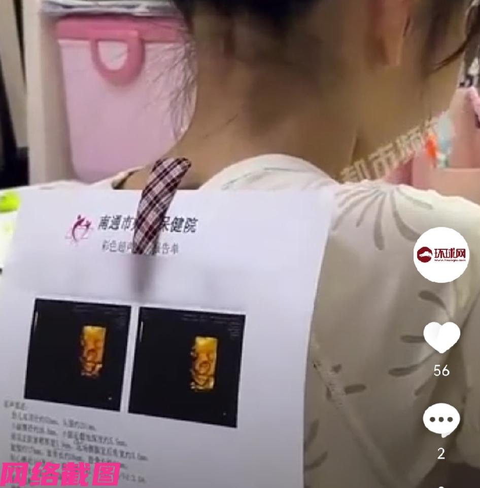 江苏有妈妈因怕自己辅导孩子作业当中发火，竟把自己当初怀孩子检查的四维彩超单用夹子