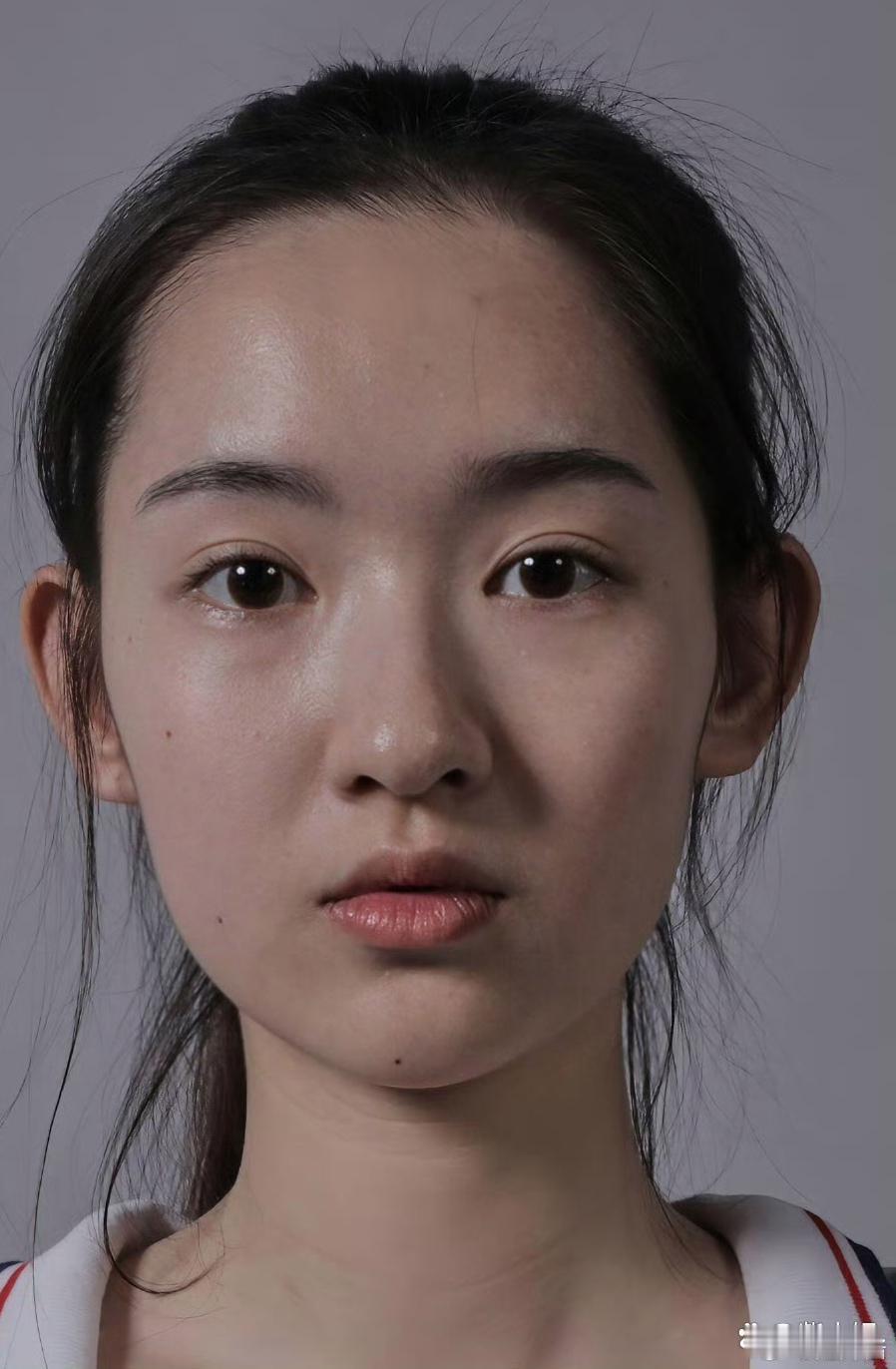 王玉雯生图，看来人的脸上都可能会有痣啊！ 