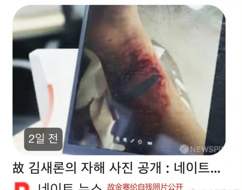韩媒曝金赛纶自残照 韩媒曝金赛纶自残照！！韩媒发了金赛纶收到金秀贤催还钱后的自残