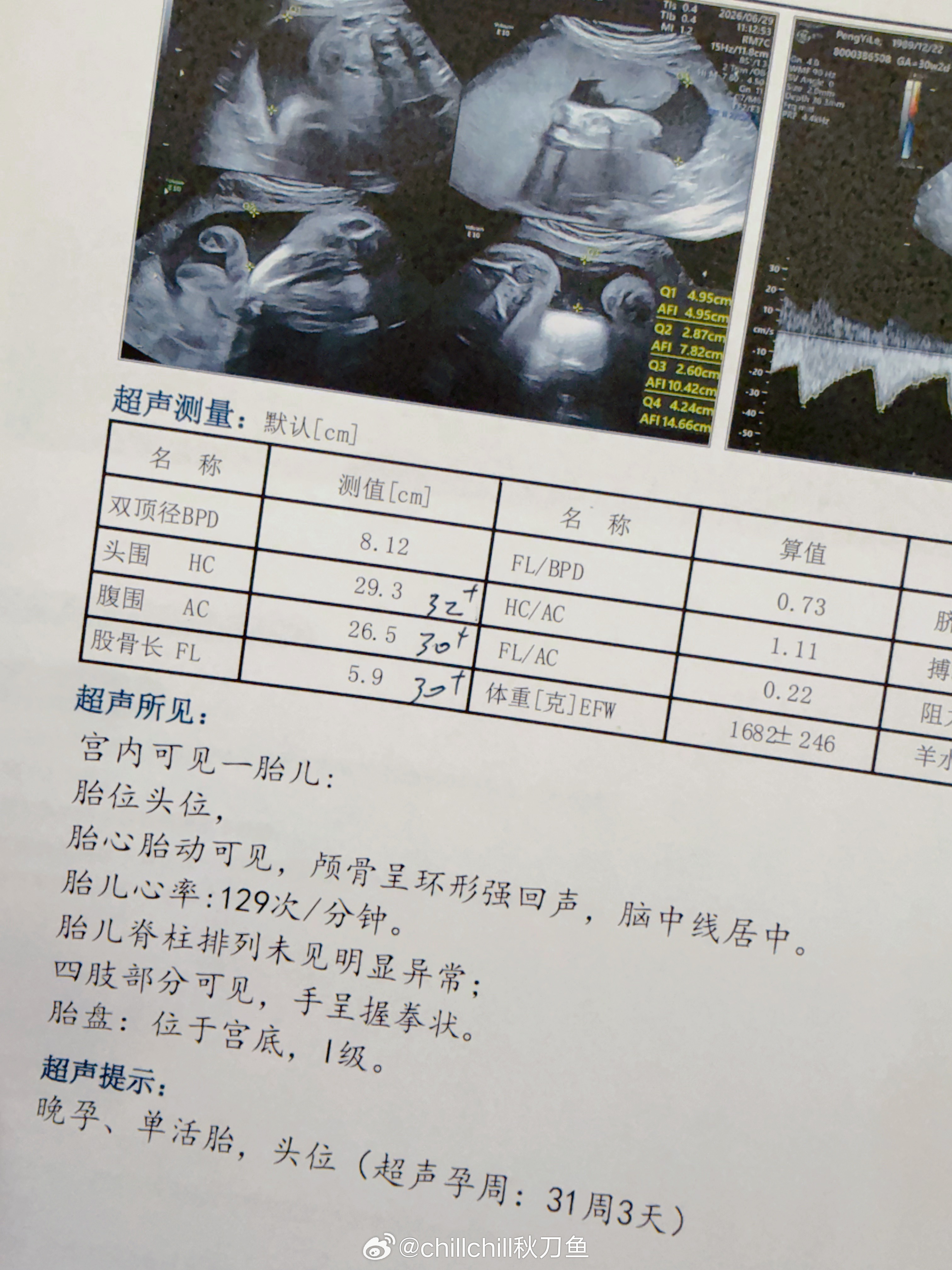 咋整啊这位小朋友，为什么要遗传爸爸的大头呢？