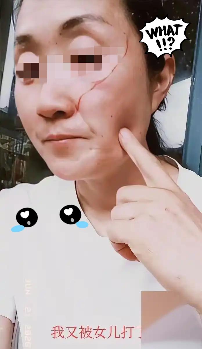 高考刚结束，这孩子反手给了亲妈一巴掌，脸都打破了。

理由荒唐得让人发笑：嫌妈做