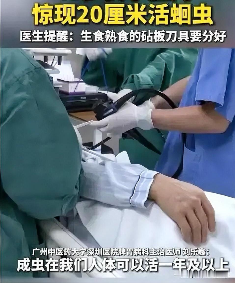 2025年10月，湖北十堰58岁的王女士因反复腹痛就医，医生在肠镜检查中发现一条