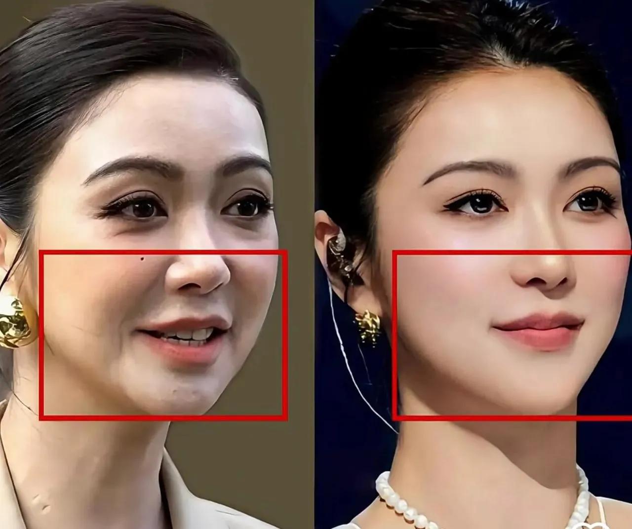 整容后果然更美，最成功的医美。